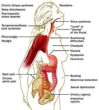 IBS EFFECT ON BODY