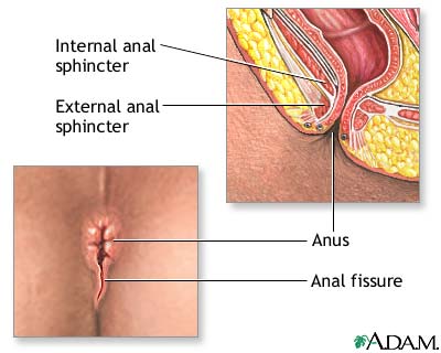 Anal Spasm 104