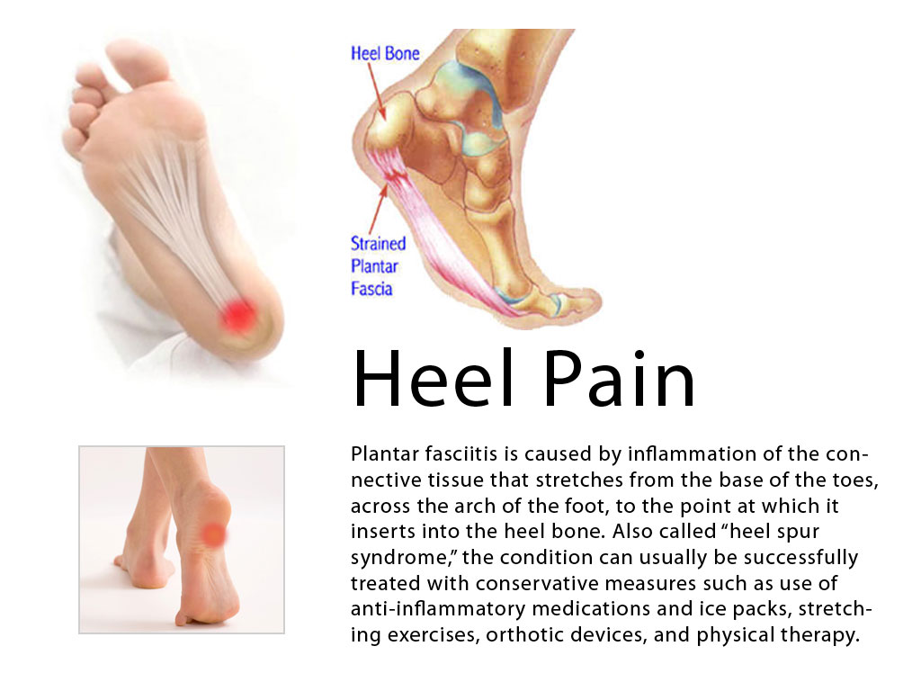 What are some causes of foot pain in the arch area?