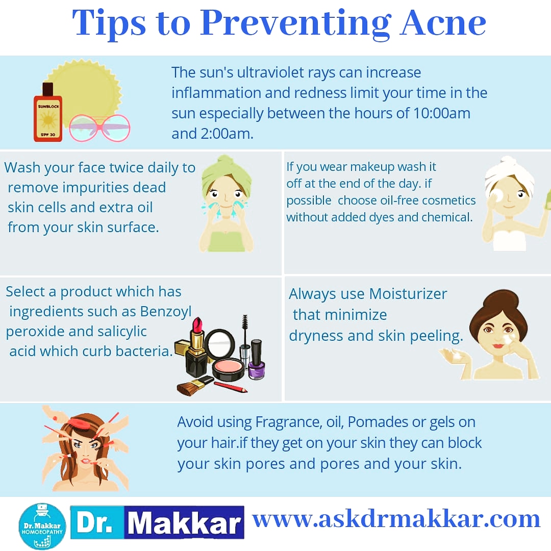 Acne prevetion tips