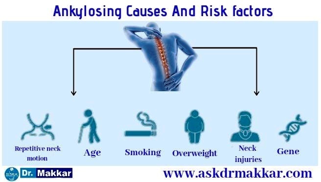 Causes of Ankylosing spondylitis also named AS due Hla B27 gene || आंकिलोसिंग स्पॉन्डिलाइटिस(अस्थिसमेकन )  के कारण