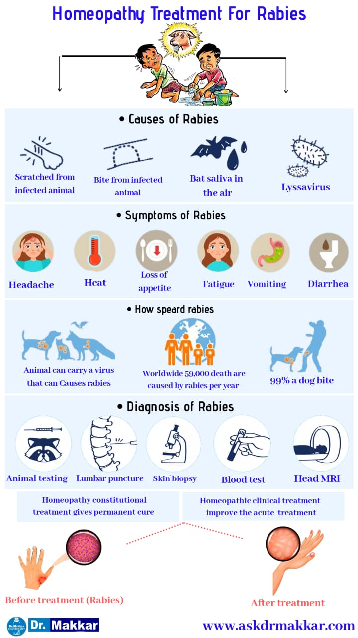 Best Rabies Homeopathic treatment