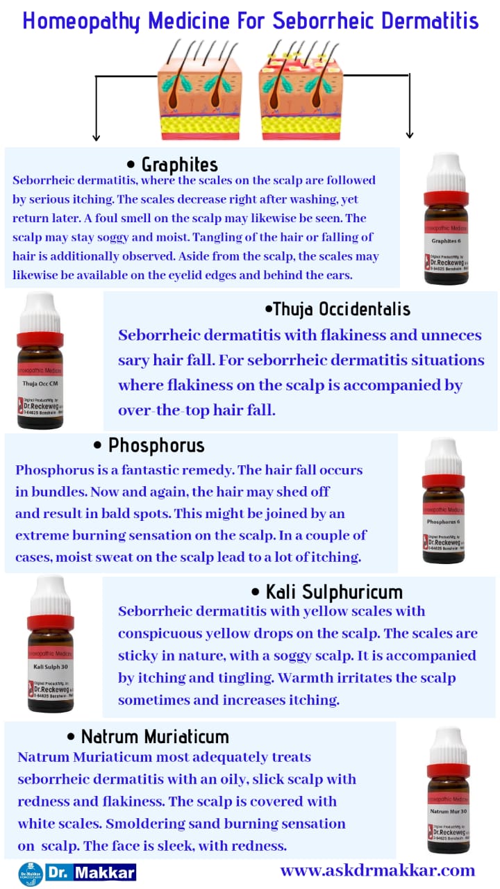 Best Homeopathic Medicine for Seborrhic Dermatitis top remedies  डैंड्रफ या सेबोरहीक डर्मेटाइटिस का होम्योपैथिक दवा