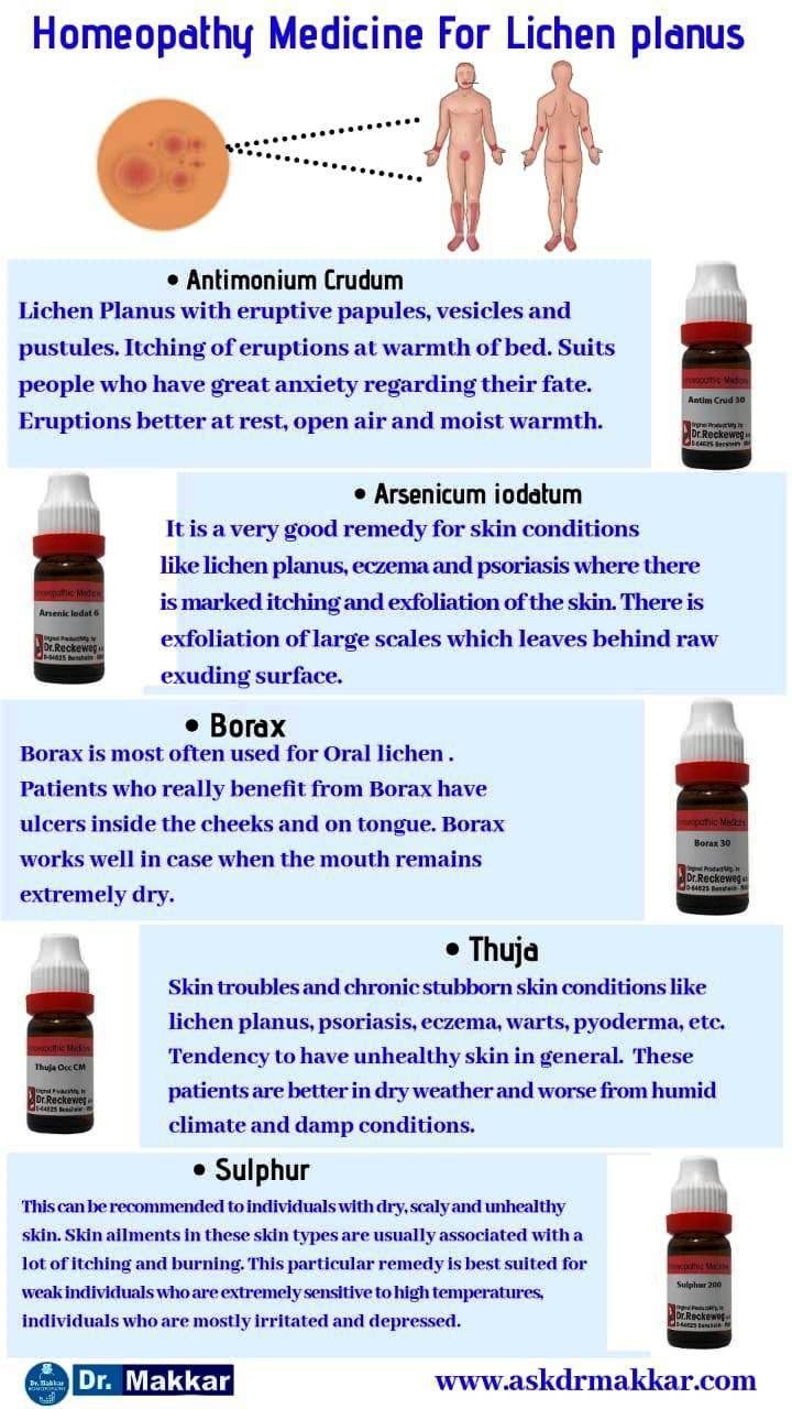 Best Homeopathic Medicine for lichen planus top remedies By Dr Makkar India Punjab Best Homeopathic Medicine for lichen planus top remedies By Dr Makkar India Punjab||  बेस्ट होम्योपैथिक मेडिसिन फॉर लिचेन प्लेनस टॉप रेमेडीज बाय डॉ। मक्कड़ इंडिया पंजाब