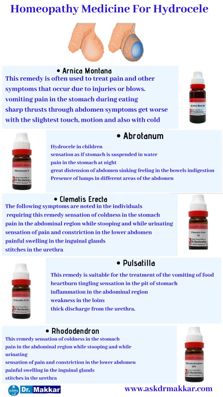 Best Homeopathic Medicines for Hydrocele || हाइड्रोसेले  की होम्योपैथिक ट्रीटमेंट दवा सर्वश्रेष्ठ होम्योपैथिक उपचार