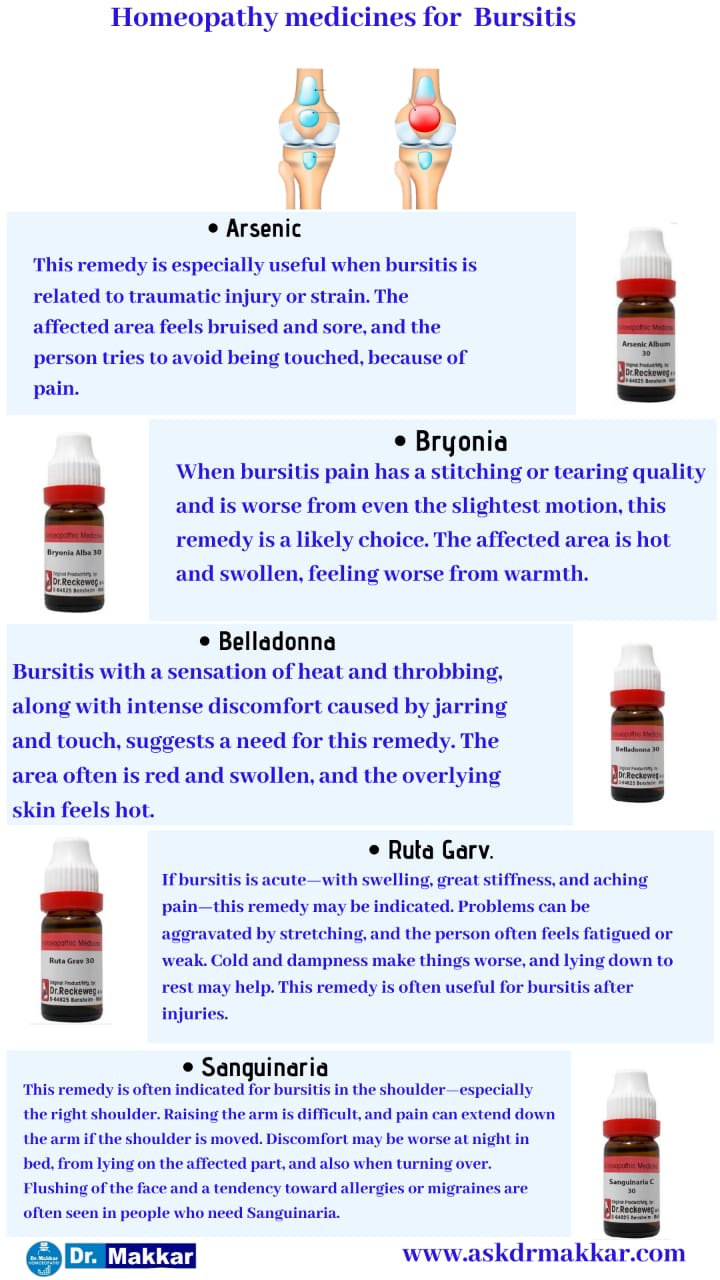 Best Homeopathic Medicines for top Remedies for Bursitis || बर्साइटिस की होम्योपैथिक ट्रीटमेंट दवा सर्वश्रेष्ठ होम्योपैथिक दवा शीर्ष उपाय
