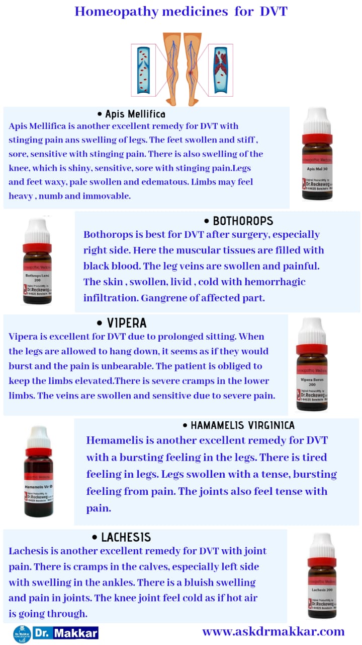 Best Homeopathic Medicines for top Remedies for Deep Vein Thrombosis DVT || डीप वेन थ्राम्बोसिस  की होम्योपैथिक ट्रीटमेंट दवा  डीवीटी सर्वश्रेष्ठ होम्योपैथिक दवा शीर्ष उपाय