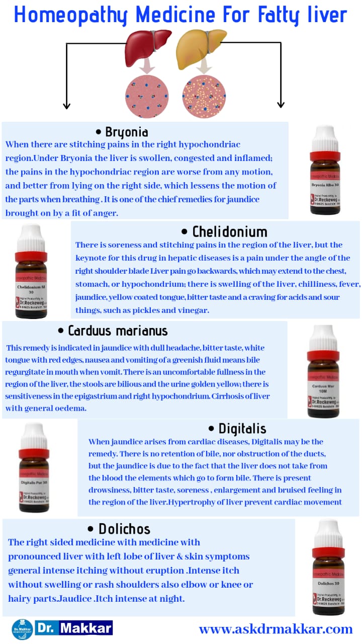 Best Homeopathic Remedies for Fatty Liver top medicines