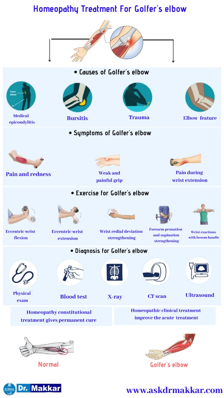 Best Homeopathic Treatment approach to Golfers Elbow || गोल्फर एल्बो के लक्षण के लक्षण का होम्योपैथिक दवा से इलाज होम्योपैथिक ट्रीटमेंट