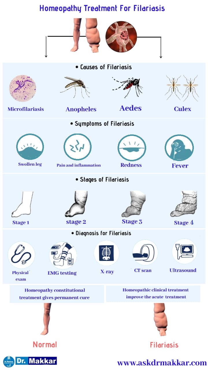 Best Homeopathic Treatment approach to Elephantiasis Lymphatic Filariasis || लसीका फाइलेरिया का होम्योपैथिक दवा से इलाज हाथीपाँव होम्योपैथिक ट्रीटमेंट
