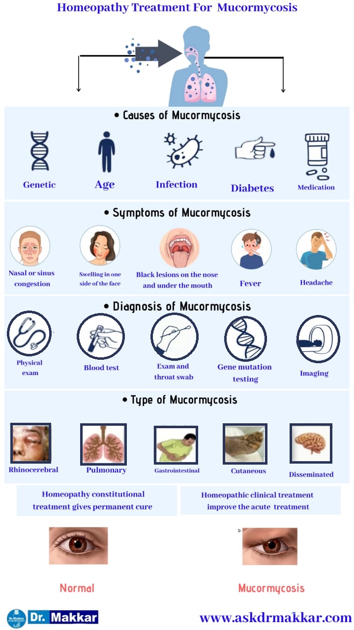 Best Homeopathic Treatment approach to  Mucormycosis || Black Fungus || Zygomycosis || ब्लैक फंगस का होम्योपैथिक दवा से इलाज होम्योपैथिक ट्रीटमेंट