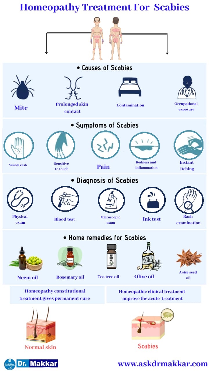 Best Homeopathic Treatment approach to  Scabies with Homeopathic medicine || स्केबीज या खाज  का होम्योपैथिक इलाज सर्वश्रेष्ठ होम्योपैथिक ट्रीटमेंट होम्योपैथिक दवाएं से