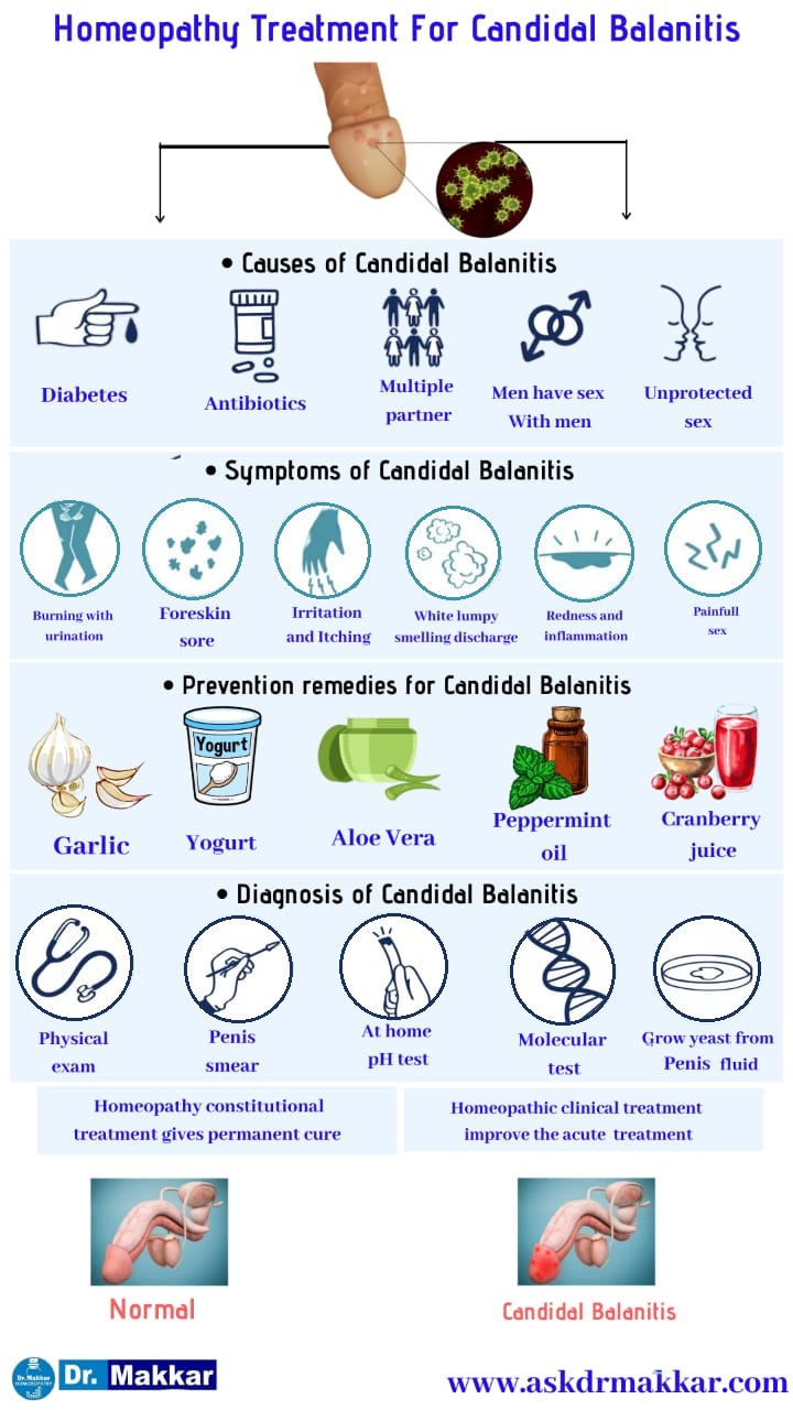 Best Homeopathic Treatment approach to Balanitis  बैलेनाइटिस यीस्ट  योनि में खुजली जलन संक्रमण तरु