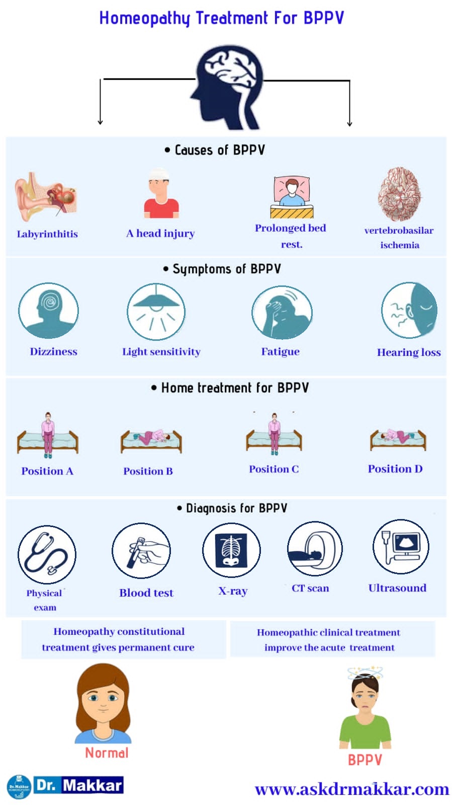 Best Homeopathic Treatment approach to Benign Paroxysmal Positional Vertigo BPPV ||  बिनाइन पैरॉक्सिसमल पोजिशनल वर्टिगो सिर घूमना का होम्योपैथिक दवा से इलाज होम्योपैथिक ट्रीटमेंट