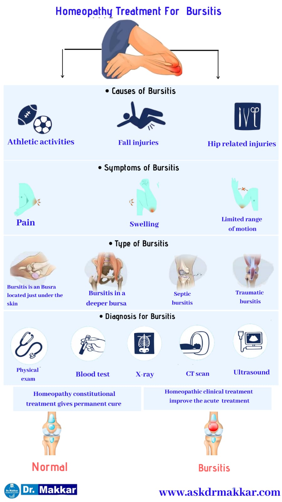 Best Homeopathic Treatment approach to Bursitis || बर्साइटिस का होम्योपैथिक दवा से इलाज होम्योपैथिक ट्रीटमेंट