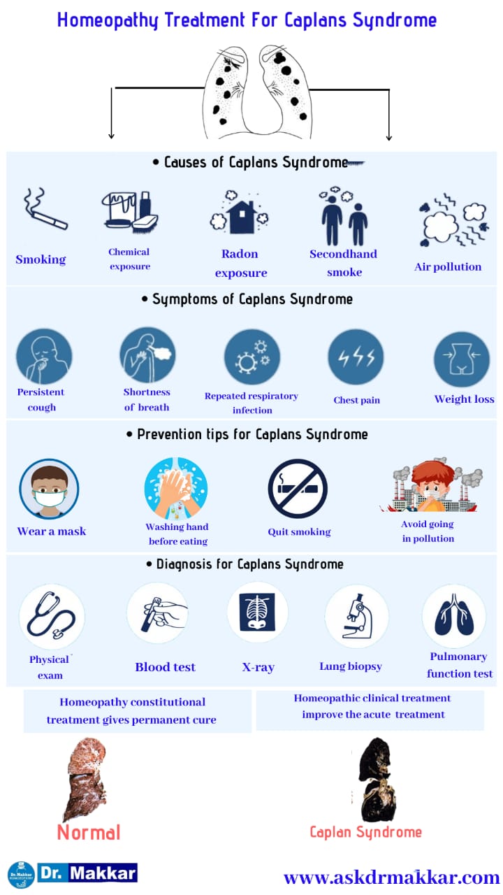 	Best Homeopathic Treatment approach to Caplan’s Syndrome || कैपलन सिंड्रोम का होम्योपैथिक दवा से इला