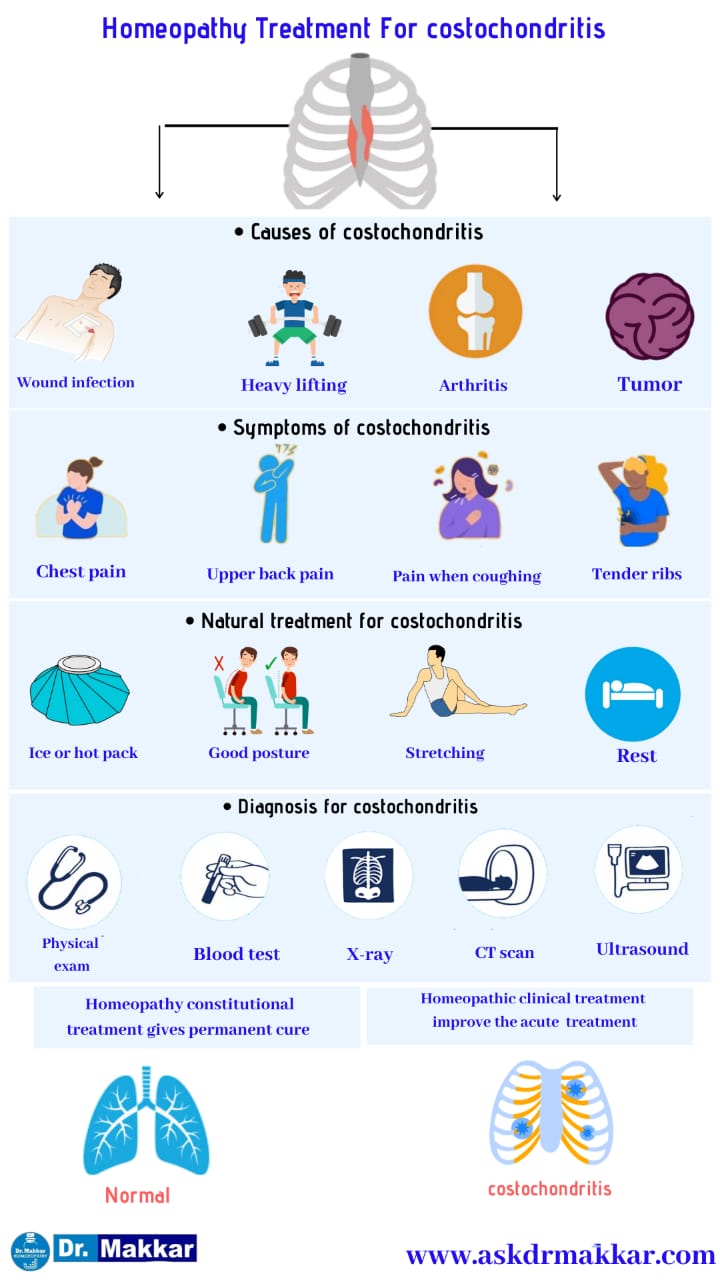 Best Homeopathic Treatment approach to Costochondritis Pain in Ribs || कोस्टोकोंडाइटिस पसली में सूजन का होम्योपैथिक दवा से इलाज होम्योपैथिक ट्रीटमेंट