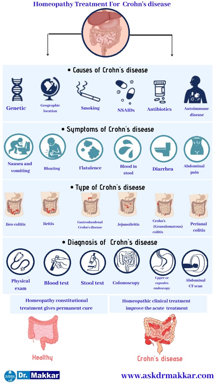Best Homeopathic Treatment approach to Crohns Disease  Inflammation of intestine || आंतों में सूजन इन्फेक्शन क्रोहन रोग की का होम्योपैथिक इलाज दवा से ट्रीटमेंट
