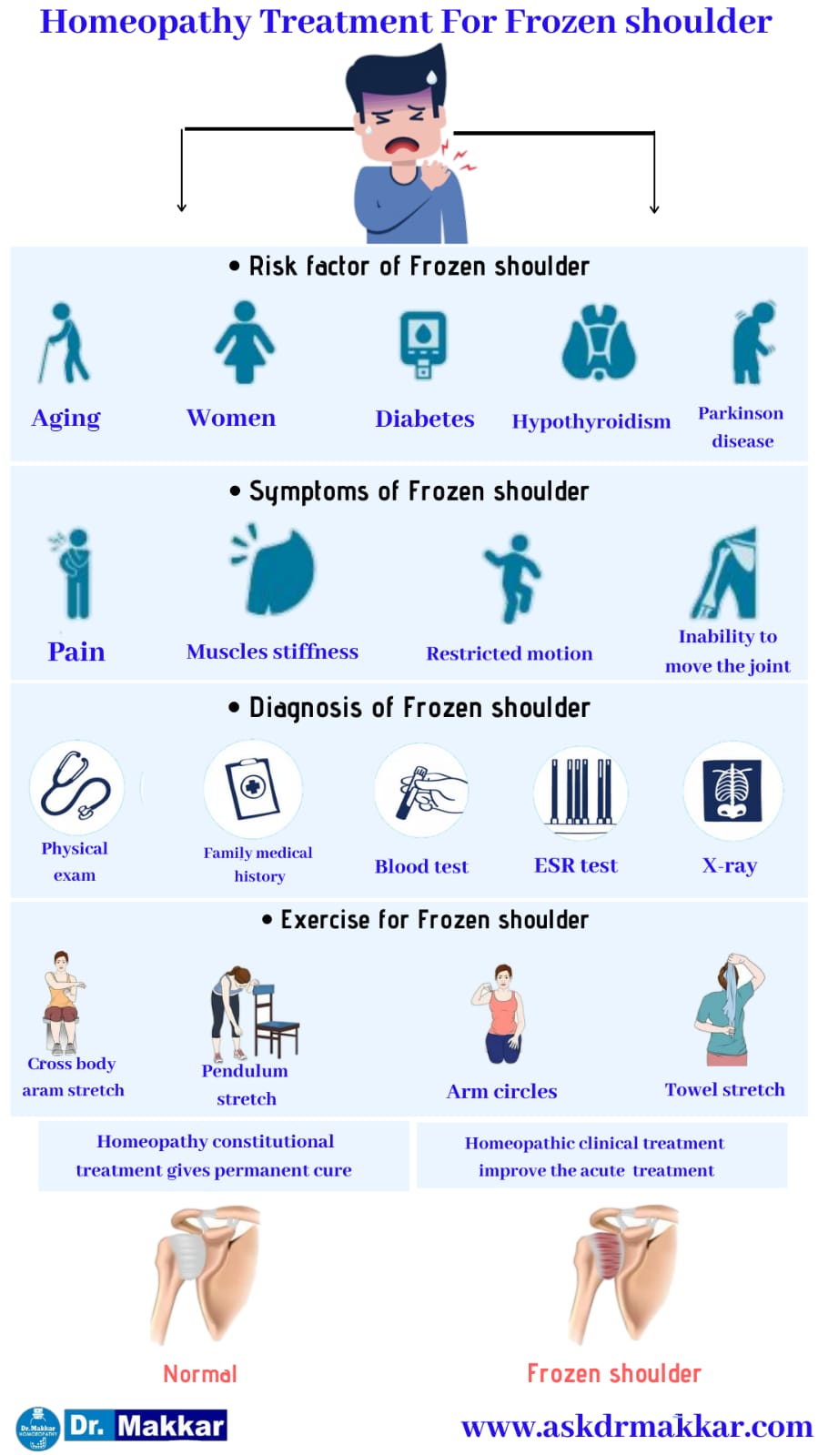 Best Homeopathic Treatment approach to Frozen Shoulder stiffness of shoulder || कंधे की अकड़न फ्रोज़न शोल्डर का होम्योपैथिक दवा से इलाज होम्योपैथिक ट्रीटमेंट