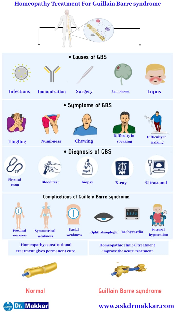 Best Homeopathic Treatment approach to Guillain Barre Syndrome || गियॉन-बार्रे सिंड्रोम नाड़ी का होम्योपैथिक दवा से इलाज होम्योपैथिक ट्रीटमेंट