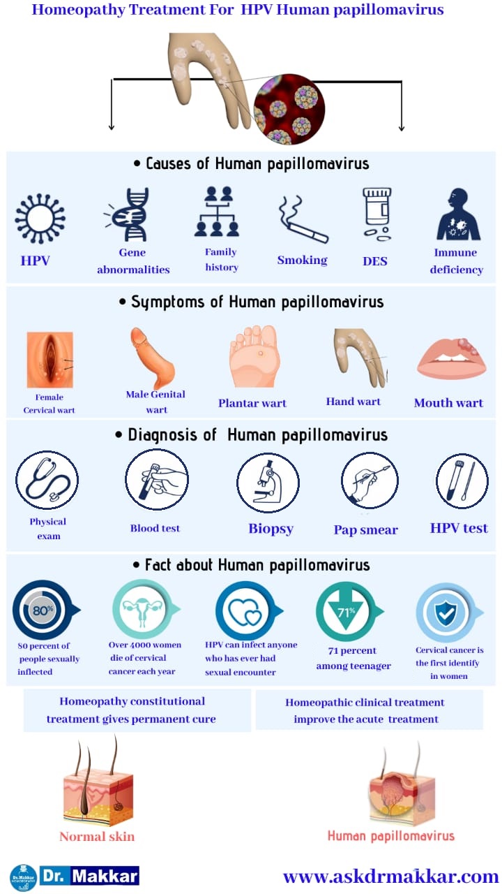 Best Homeopathic Treatment approach to Human Pappiloma Virus HPV || ह्यूमन पेपिलोमा वायरस एचपीवी  का होम्योपैथिक दवा से  इलाज होम्योपैथिक ट्रीटमेंट 