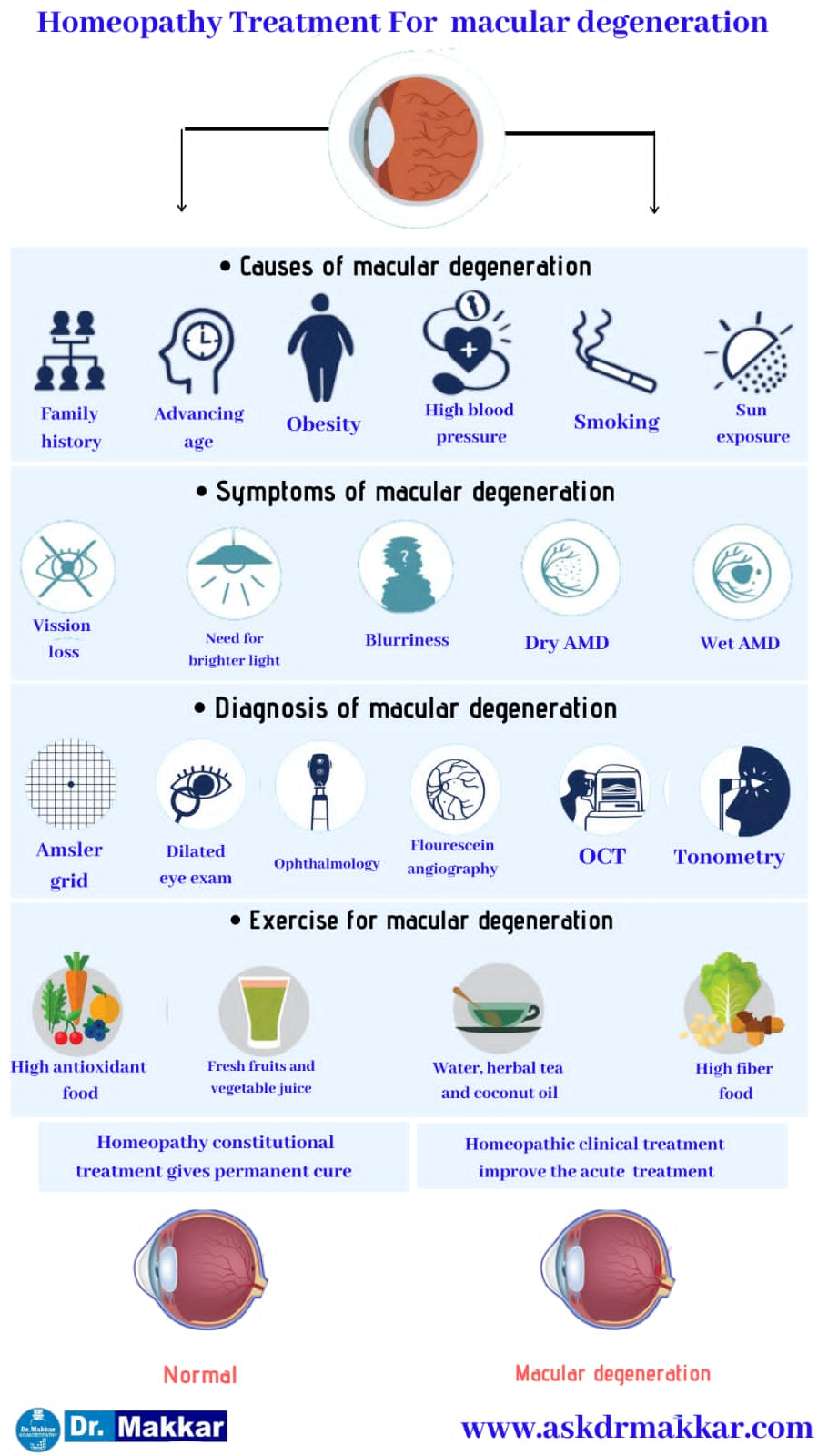 Best Homeopathic Treatment approach to Macular degeneration ARMD || मैक्युलर डीजेनेरेशन  का होम्योपैथिक दवा से इलाज होम्योपैथिक ट्रीटमेंट