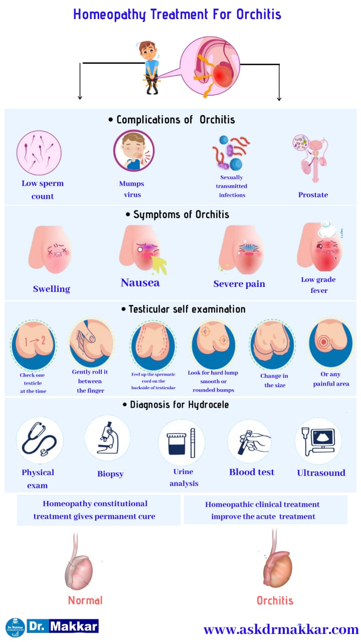 Best Homeopathic Treatment approach to Orchitis with Homeopathic medicine || ऑर्काइटिस का होम्योपैथिक इलाज बेस्ट होम्योपैथिक दवा  के साथ होम्योपैथिक ट्रीटमेंट 