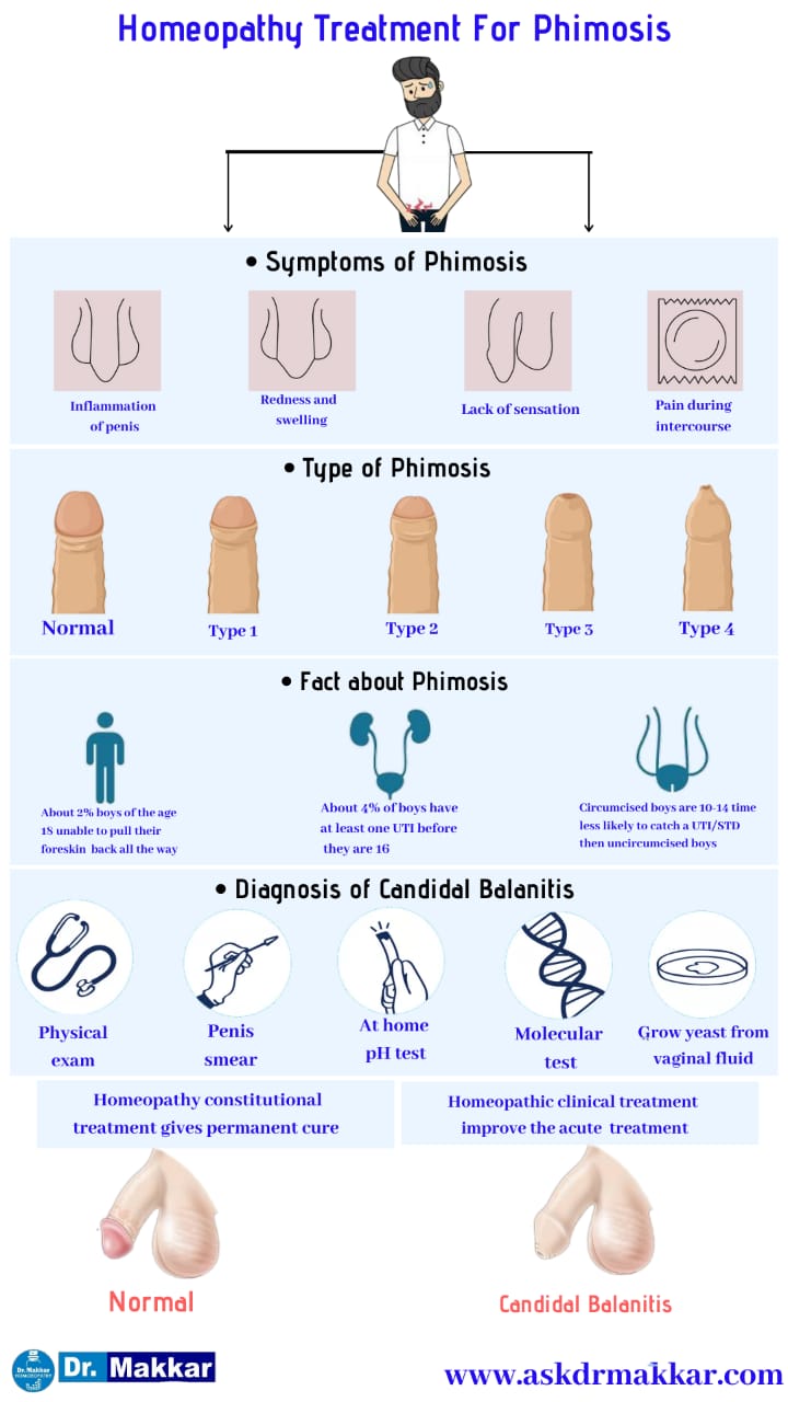 Best Homeopathic Treatment approach to Phimosis फाइमोसिस या निरुद्धप्रकाश शिश्न योनि में खुजली जलन संक्रमण तरुण योनि शोथ का होम्योपैथिक इलाज