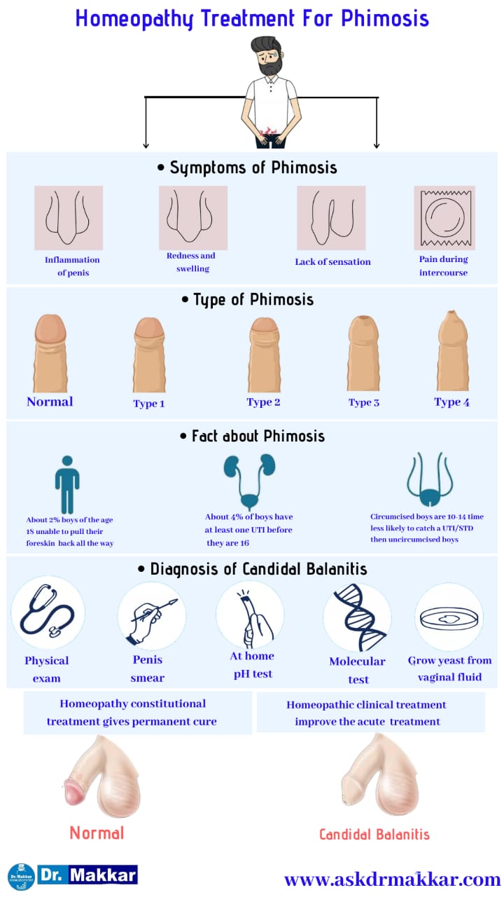 Phimosis Treatment With/Without Surgery in Delhi, India