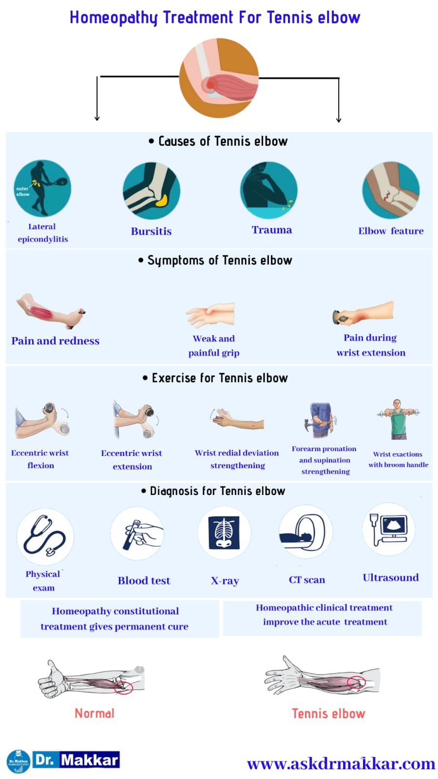 Best Homeopathic Treatment approach to Tennis Elbow || टेनिस एल्बो के लक्षण के लक्षण का होम्योपैथिक दवा से इलाज होम्योपैथिक ट्रीटमेंट