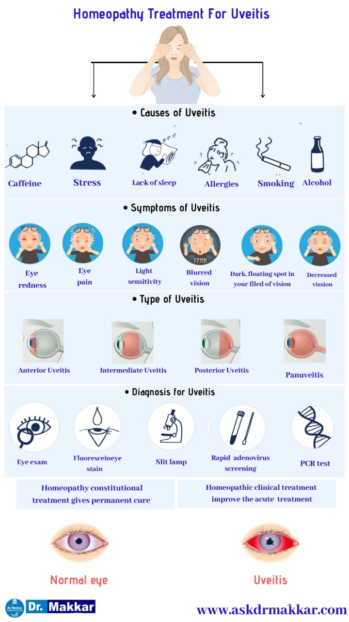 Best Homeopathic Treatment approach to Uveitis eye disease || यूवाइटिस आंखों से संबंधित रोग का होम्योपैथिक दवा से इलाज होम्योपैथिक ट्रीटमेंट