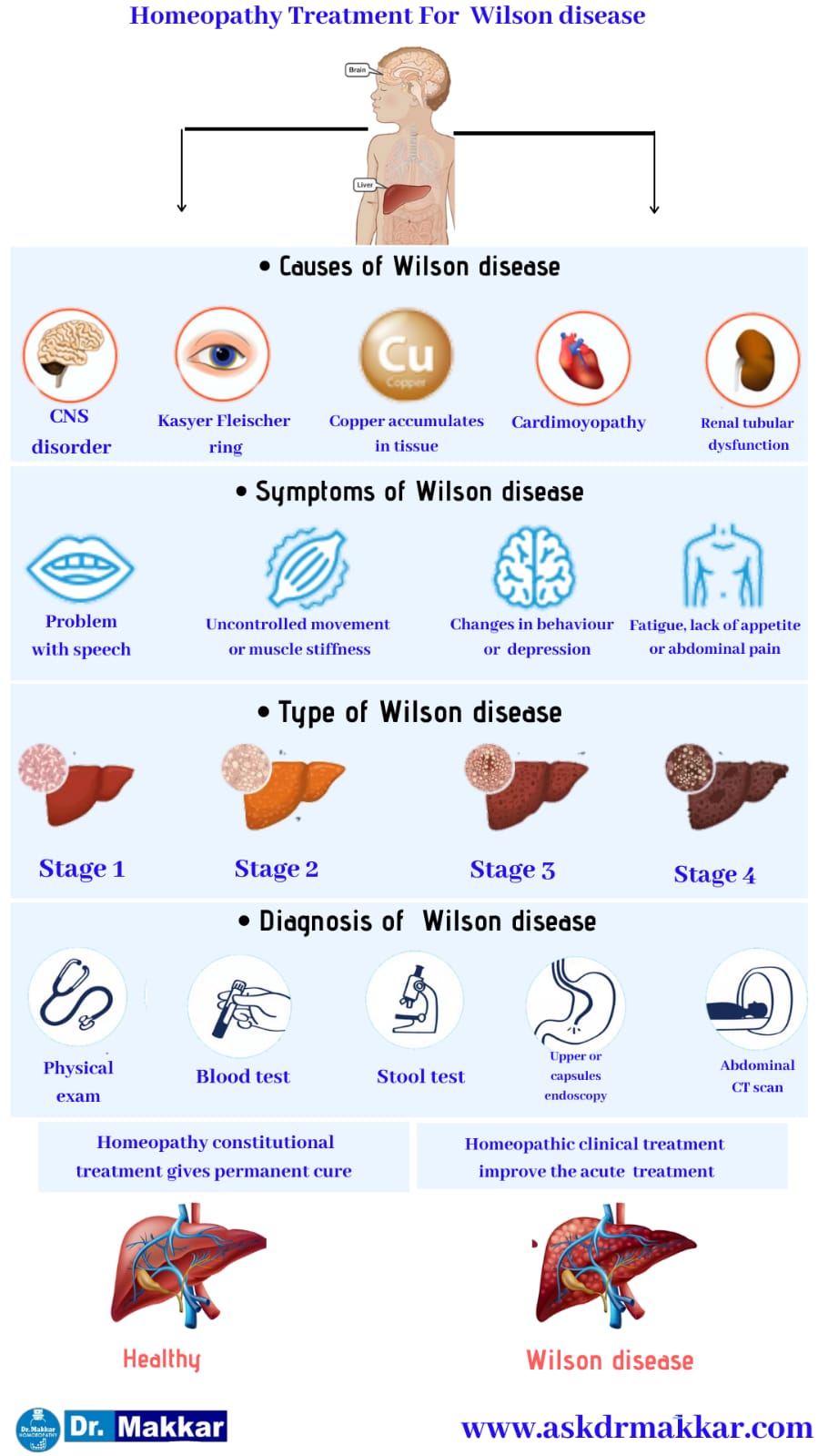 Best Homeopathic Treatment approach to Wilson Disease || विल्सन रोग का होम्योपैथिक दवा से इलाज होम्योपैथिक ट्रीटमेंट