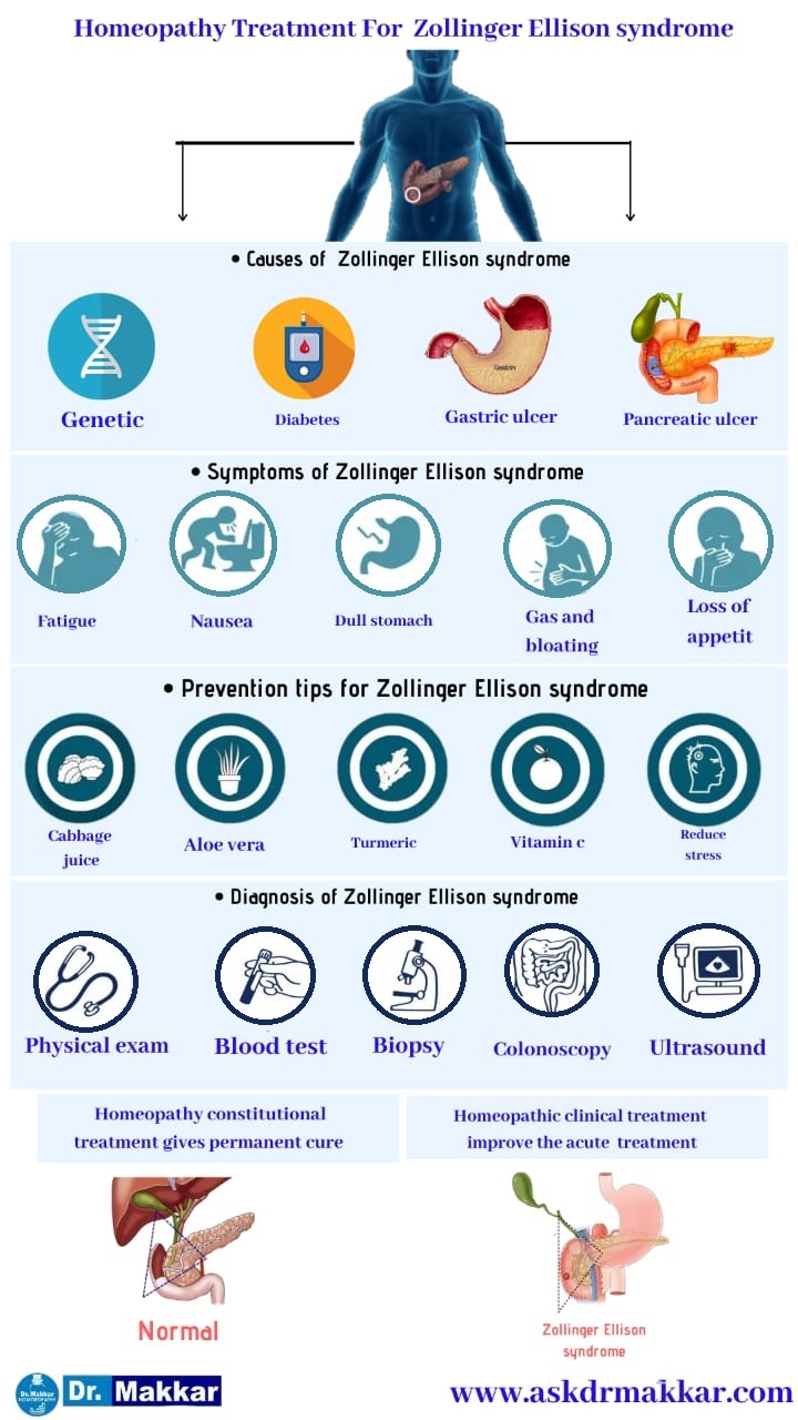 Best Homeopathic Treatment approach to Zollinger-Ellison syndrome || ज़ोलिंगर एलिसन सिंड्रोम का होम्योपैथिक इलाज बेस्ट होमियोपैथी उपचार