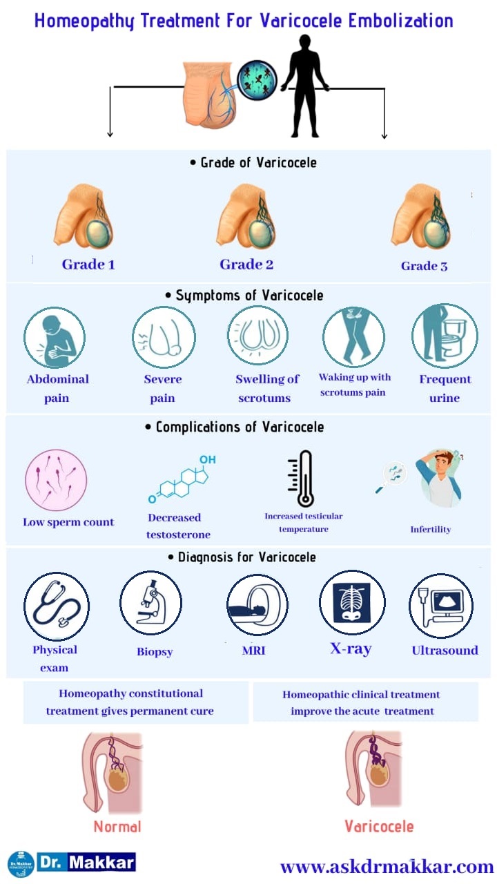 Best Homeopathic Treatment for Varicocele  with medicine ||  वैरिकोसेलेकी होम्योपैथिक ट्रीटमेंट दवा 