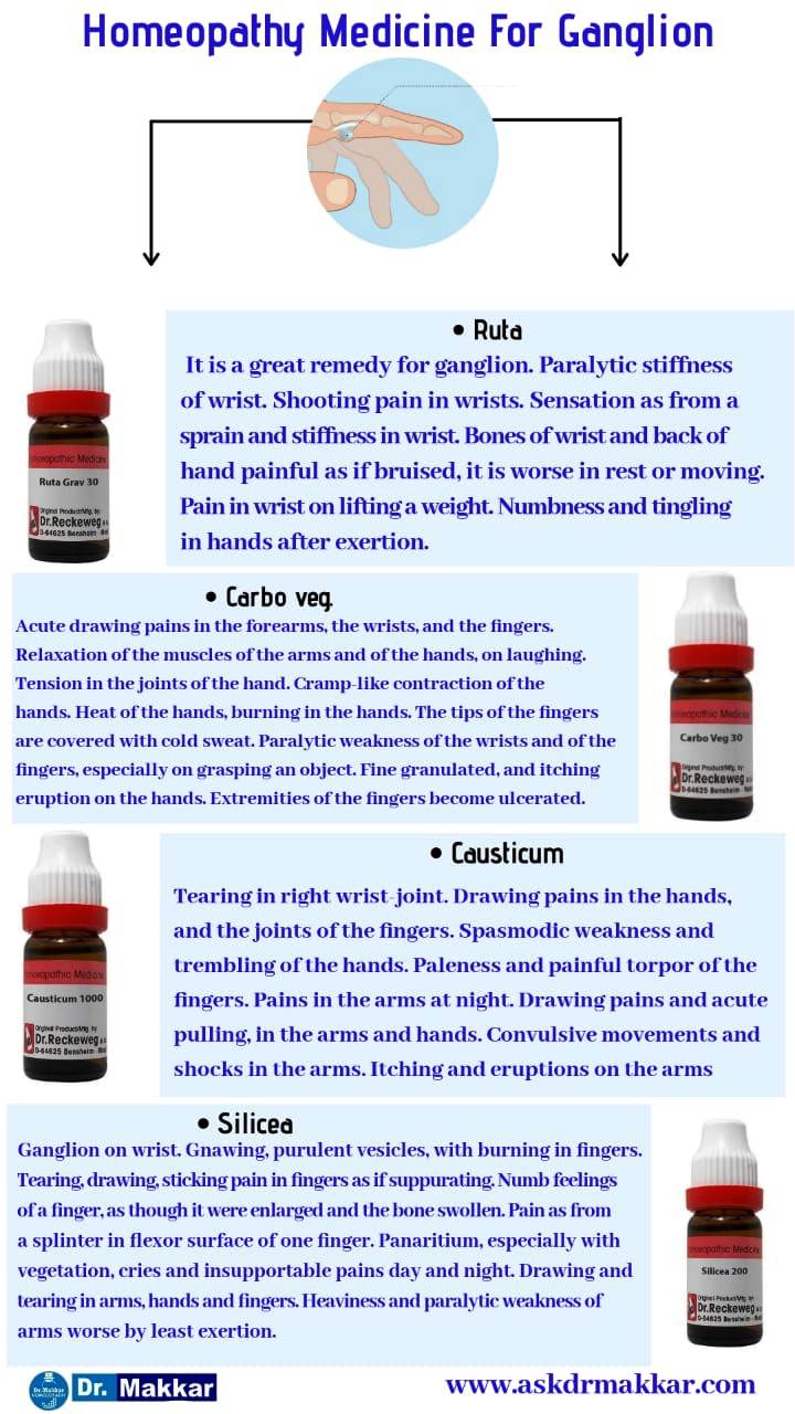 Best Homeopathic medicines for Ganglion top Remedies  ||  नाड़ीग्रन्थि गांठ की दवा