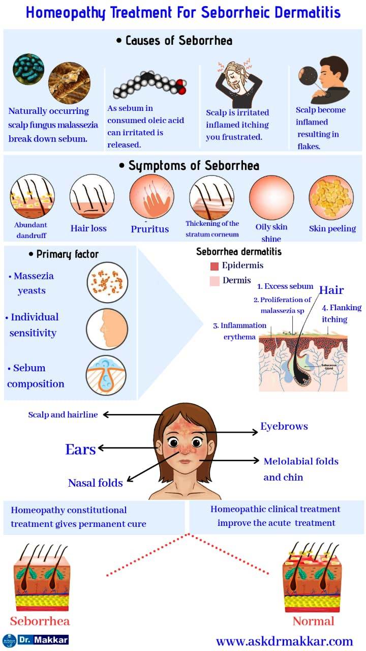 Can homeopathy cure seborrheic dermatitis? Best Homoeopathic Approach for Seborrhic Dermatitis by Dr Makkar Treatment डैंड्रफ या सेबोरहीक डर्मेटाइटिस का होम्योपैथिक इलाज
