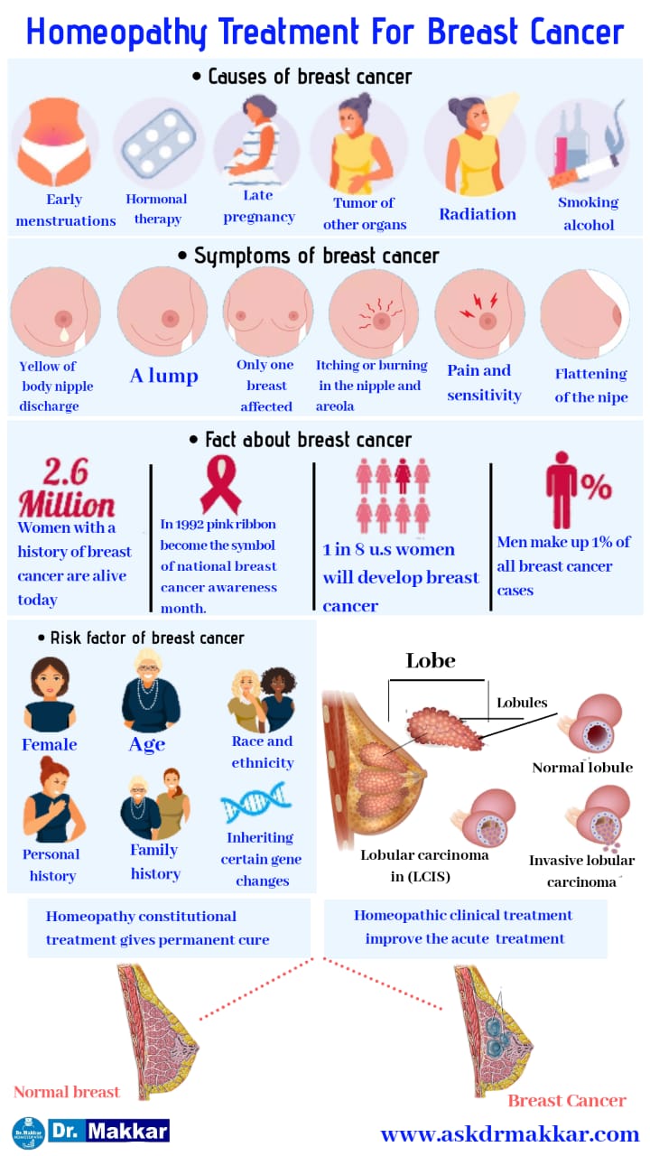 Best Homeopathic treatment for  Benign Breast tumour leads to Breast cancers