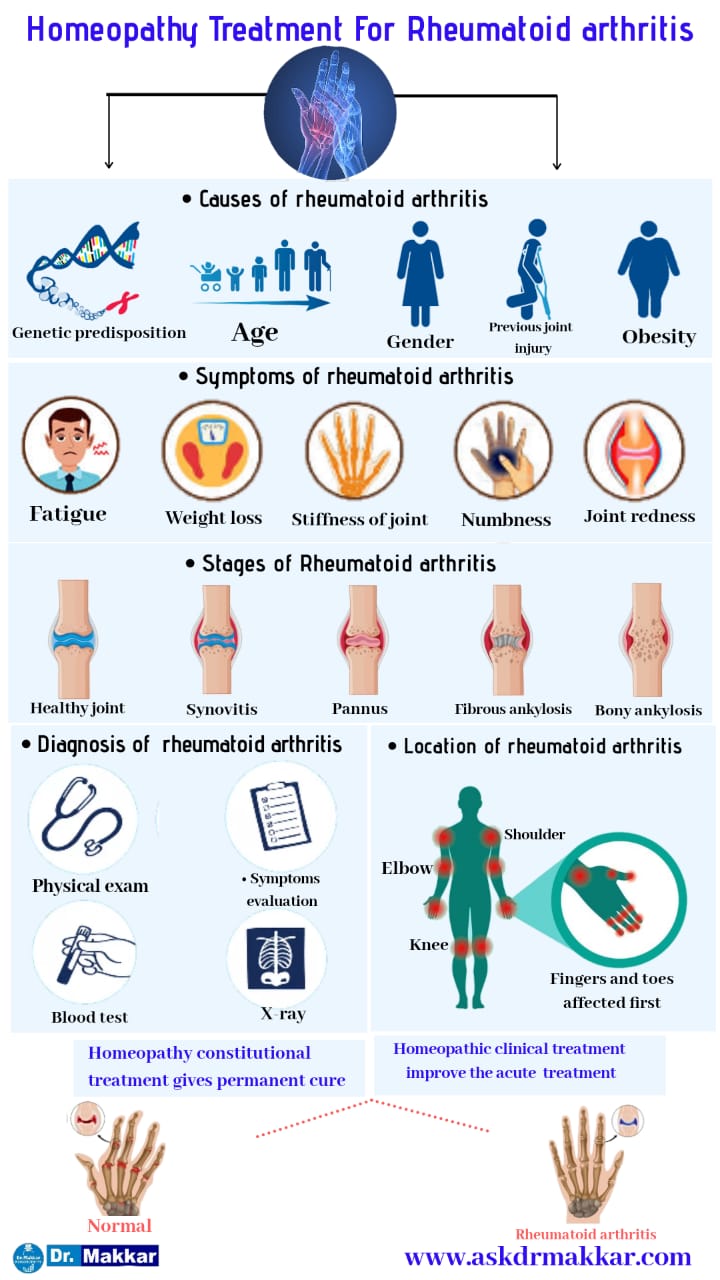 Best Homeopathic treatment for Rheumatoid arthritis