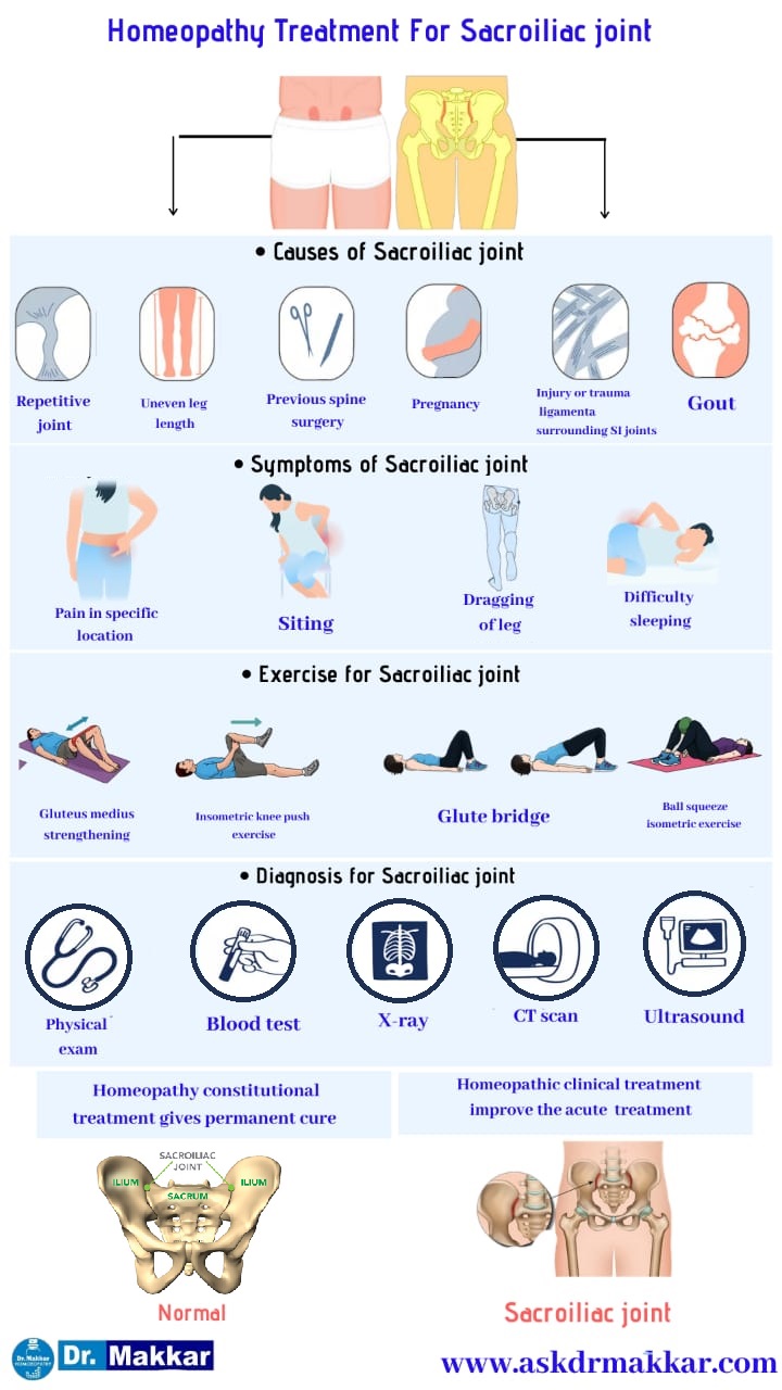 Best HomeopathicTreatment for Sacroiliac Joint Dysfunction SI Joint Pain || सैक्रोइलियक संयुक्त रोग जोड़ों का दर्द की होम्योपैथिक ट्रीटमेंट दवा से होम्योपैथिक इलाज 