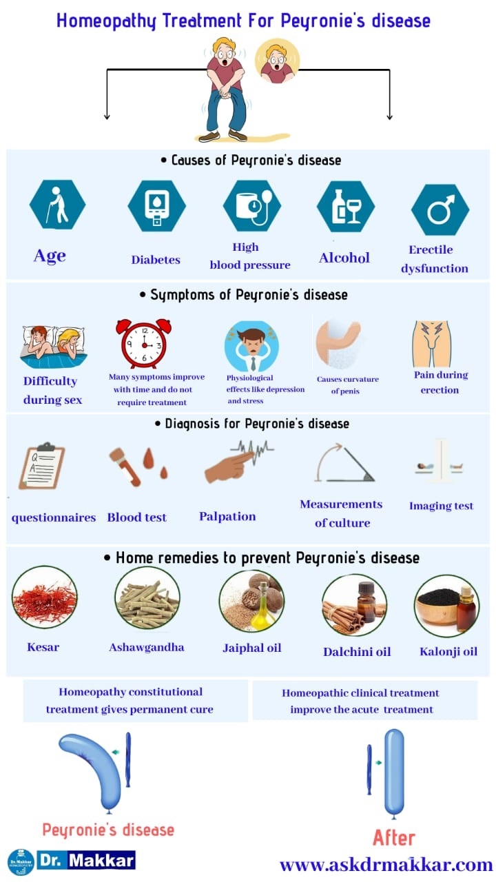 Best Homeopthic Treatment for Peyronies disease curved Penis || पेयरोनी डिजीजलिंग का टेढ़ापन मुंडा लिंग रोग दवा के साथ  बेस्ट होमियोपैथी उपचार