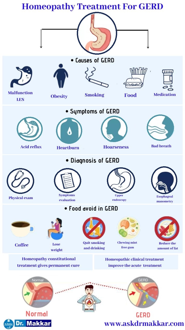 Best Homoeopathic Treatment for Gastroesophageal Reflux Disease GERD homeopathic approach ||  गैस्ट्रोओसोफेगल रिफ्लक्स रोग गर्ड होम्योपैथिक दृष्टिकोण के लिए सर्वश्रेष्ठ होम्योपैथिक उपचार इलाज