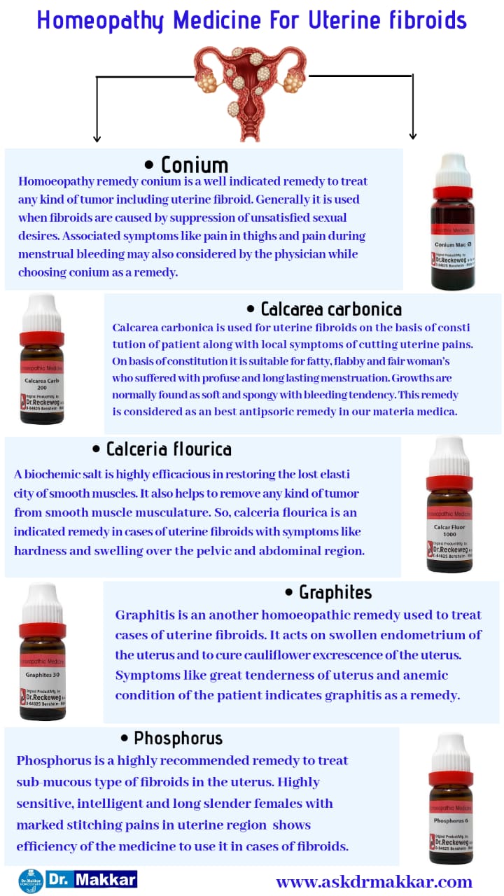 Best Homoeopathic medicine treatment with homeopathy Uterine fibroid which also called as myoma || होम्योपैथी के साथ बेस्ट होम्योपैथिक दवा उपचार यूटेराइन फाइब्रॉएड जिसे मायोमा भी कहा जाता है