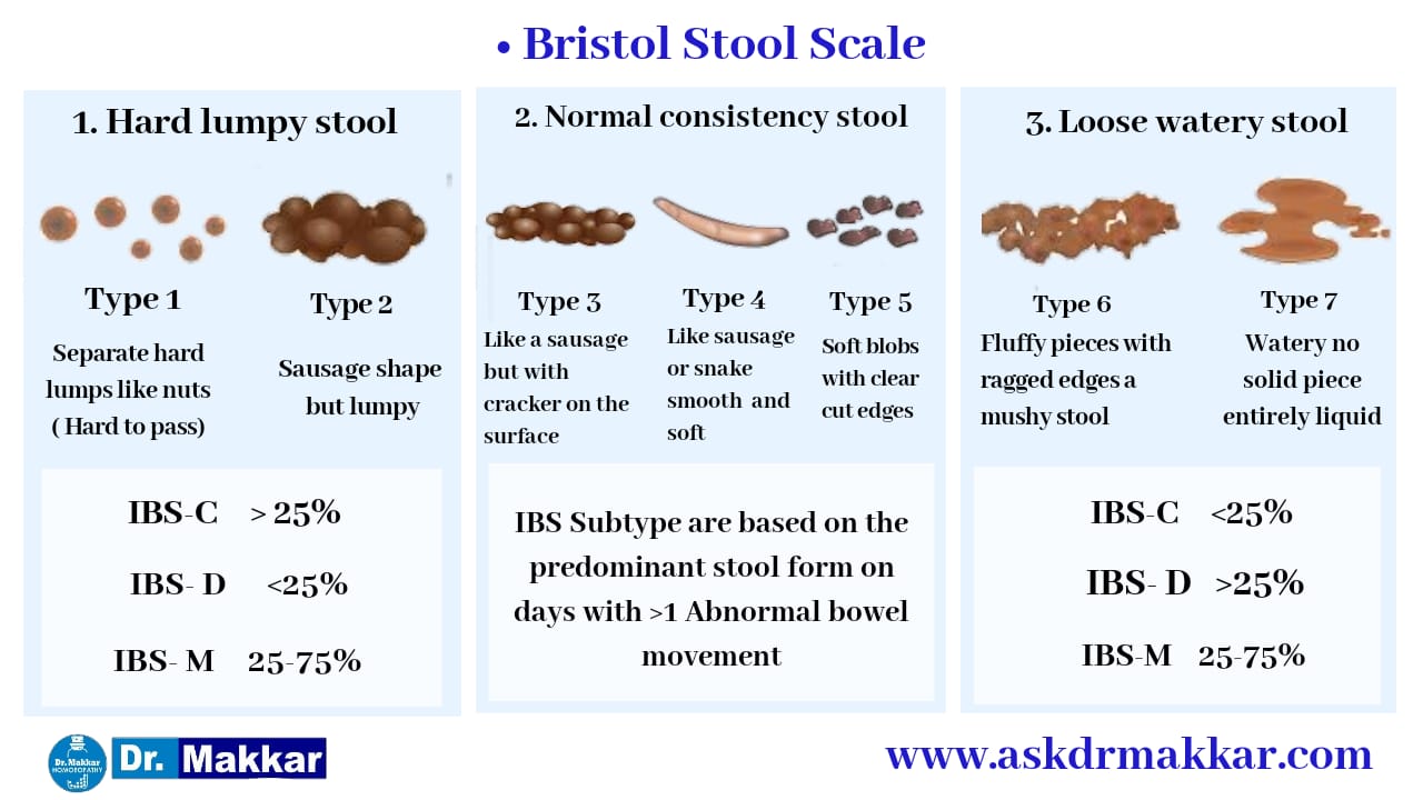 Bristol Stool Examination Relation to IBS-C vs IBS-D