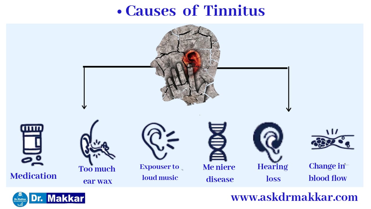 Causes of Tinnitus ||  टिनिटस के कारण