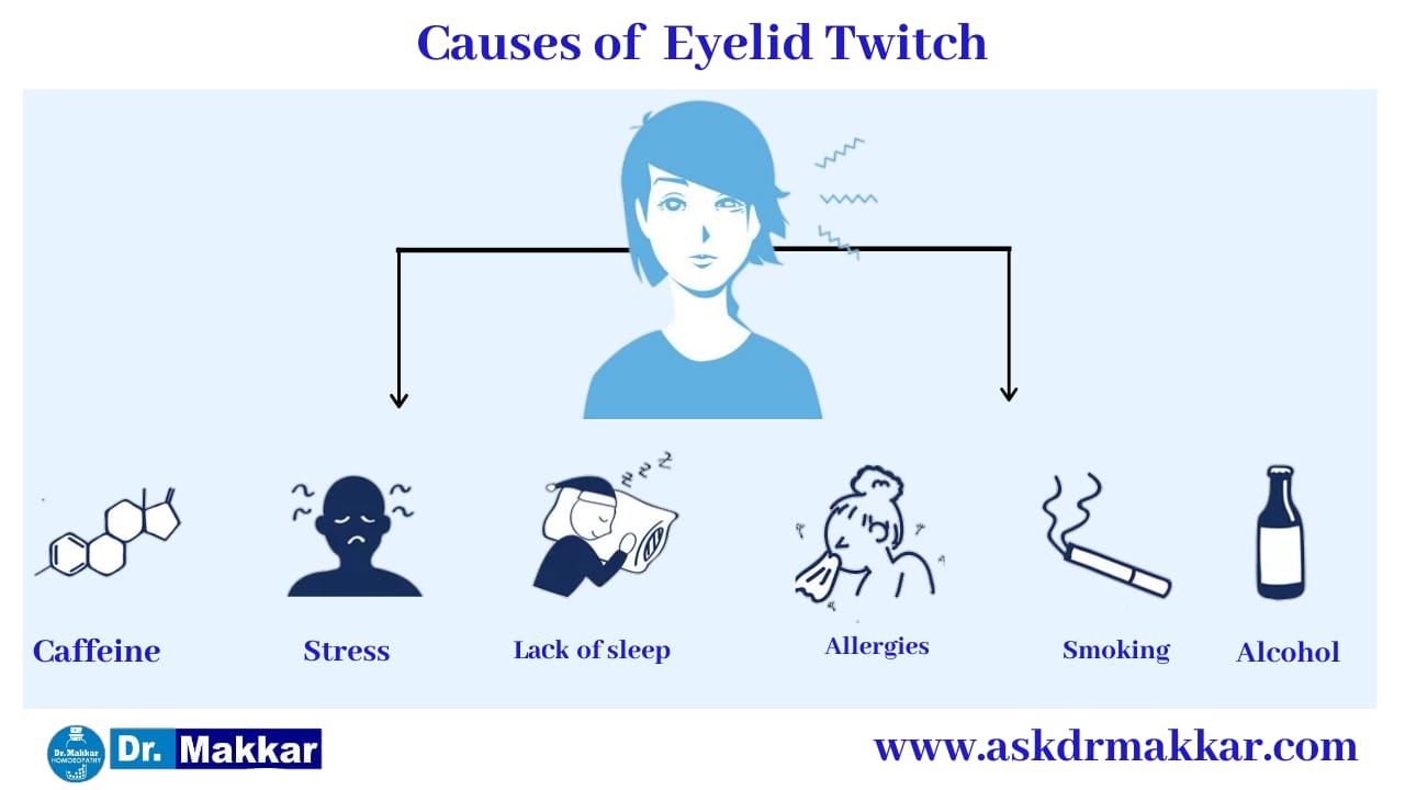 Cause of Blepharospasm Twitching eyelid || ब्लेफरोस्पाज्म आंख फड़कने झपकना  के कारण