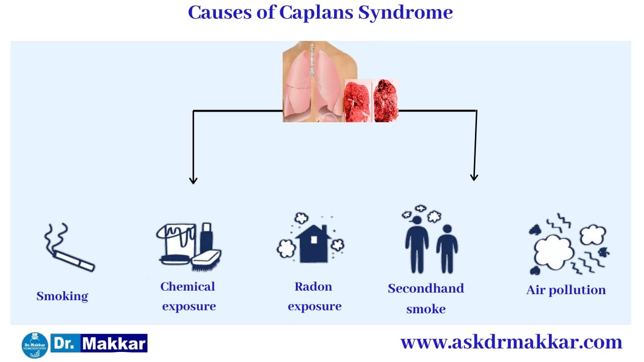 Cause of Caplan’s Syndrome || कैपलन सिंड्रोम के कारण