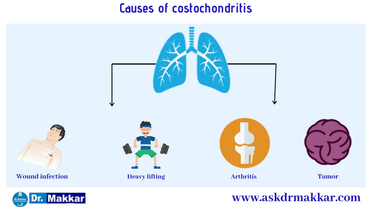 Cause of Costochondritis Pain in Ribs || कोस्टोकोंडाइटिस पसली में सूजन के कारण