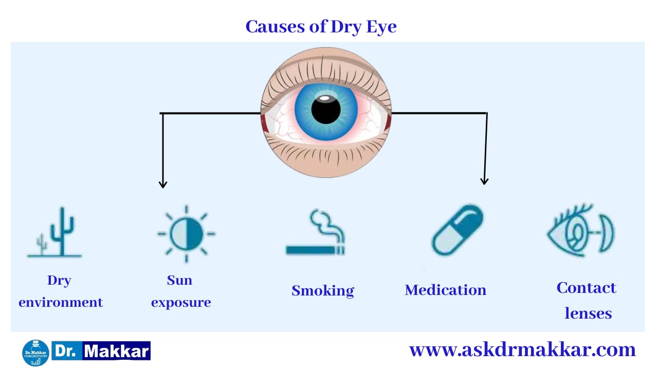 Cause of Dry Eye Keratoconjunctivitis ||  सूखी आँख केराटोकोनजक्टवाइटिस के कारण