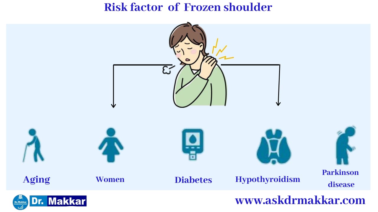 Cause of Frozen Shoulder stiffness of shoulder ||  कंधे की अकड़न फ्रोज़न शोल्डर के कारण