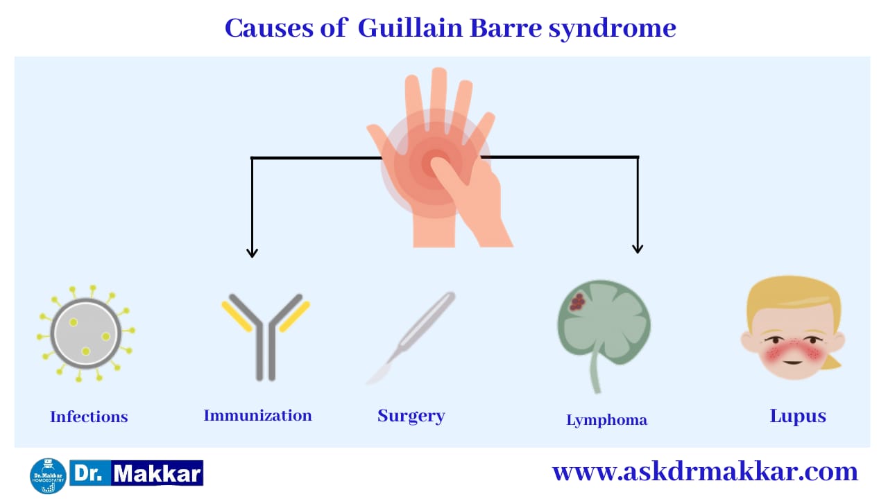 Cause of Guillain Barre Syndrome ||  गियॉन-बार्रे सिंड्रोम नाड़ी  के कारण